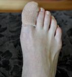 Bandaged toe.